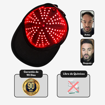 TITAN™-Reactiva tus folículos sin químicos ni hormonas